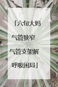 六旬大妈气管狭窄 气管支架解呼吸困局